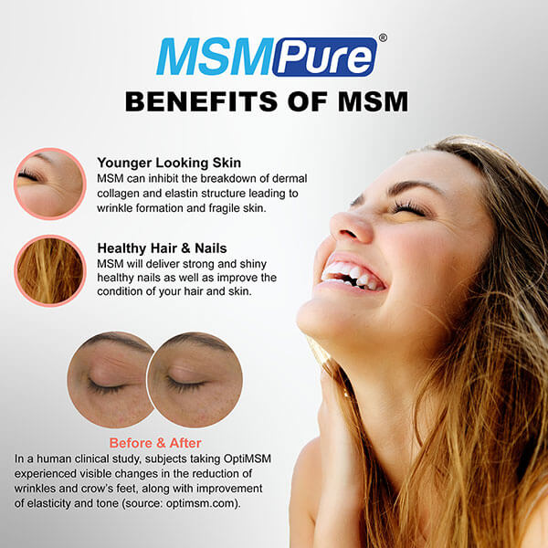 MSMPure Max Strength MSM Gel with Organic Aloe – 8 oz, Preservative-Free Skin Care for Smooth, Radiant Skin- US-Sourced MSM - Image 3